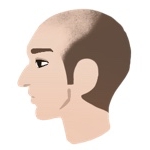 AGAのⅤ a型の横顔イラスト