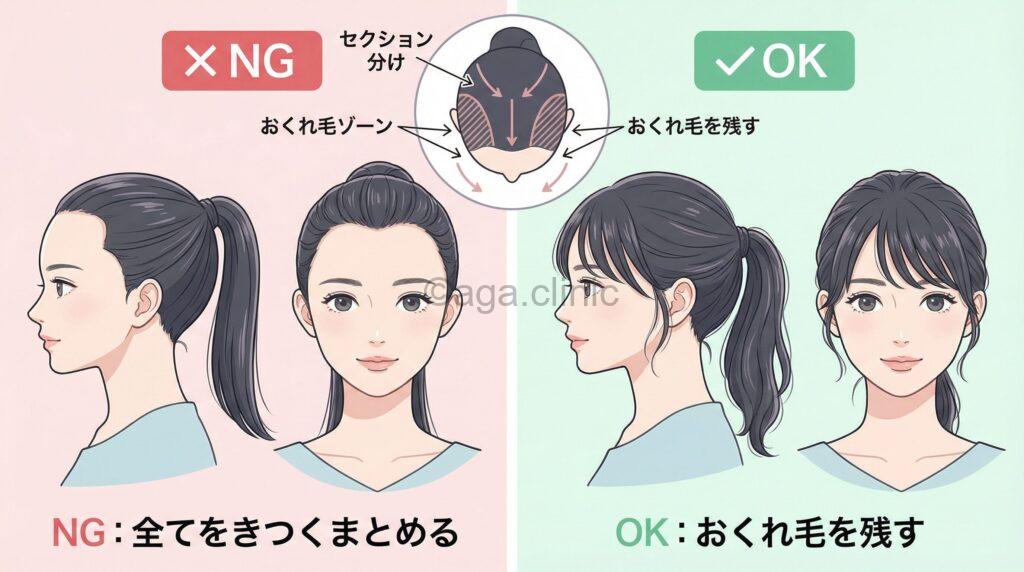 M字はげカバーのための結び方テクニッ