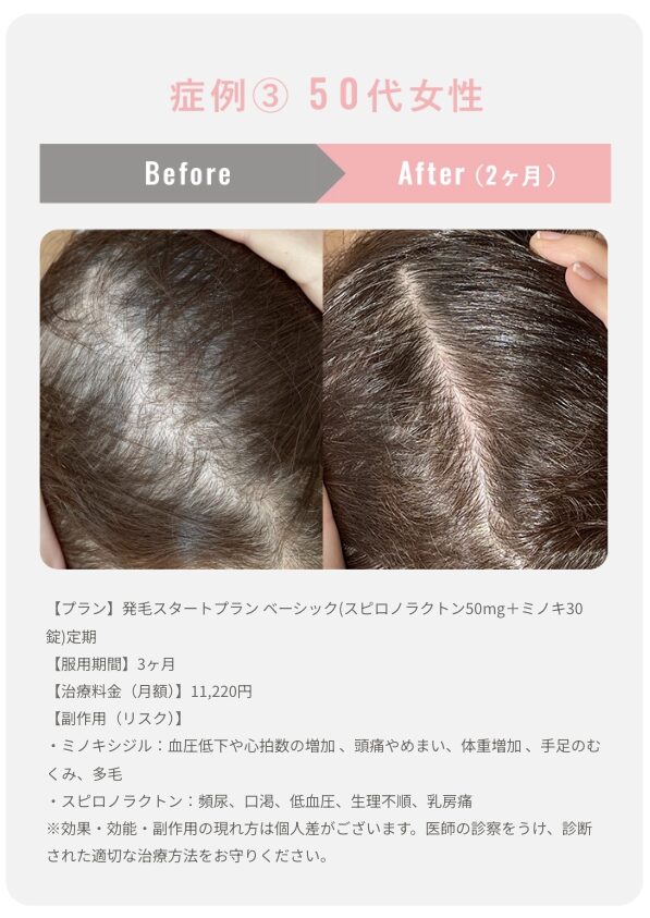 クリニックフォアFAGA症例3