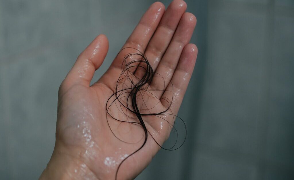 濡れた手に抜け毛がまとわりついている様子