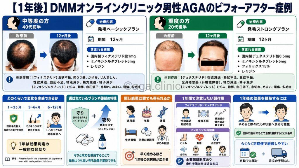 「【1年後】DMMオンラインクリニック男性AGAのビフォーアフター症例」というタイトル記事を要約した当サイトのオリジナル解説イラスト